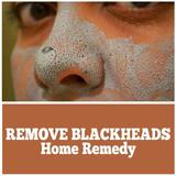 Remove Blackheads Home Remedy icono