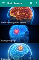 برنامه‌نما Brain Cancer عکس از صفحه