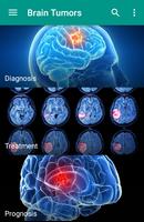 Brain Cancer ภาพหน้าจอ 3