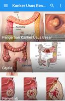 Kanker Usus Besar captura de pantalla 1