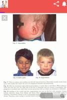 Illustrated  Pediatric Signs capture d'écran 3