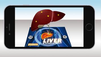 Polifarma Liver AR-poster