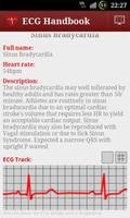 2 Schermata Heart ECG Handbook - Lite
