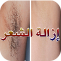 ازالة الشعرنهائيا بطرق طبيعية 2018