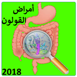 أمراض القولون