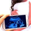 Baby Ultrasound Scanner :Prank
