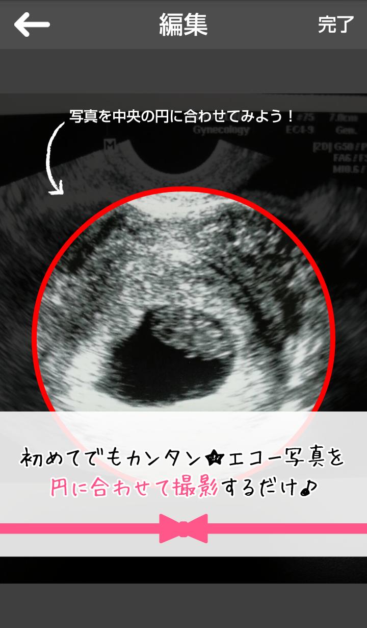 妊娠エコーフレーム エコー写真をかわいいフレームでシェア For Android Apk Download