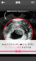 妊娠エコーフレーム-エコー写真をかわいいフレームでシェア- imagem de tela 1