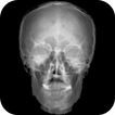 X-ray Skeleton