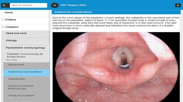 ENT Surgery Atlas ảnh chụp màn hình 2