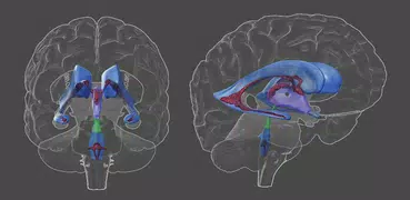 3D Brain