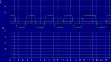 Stress Meter Wireless free captura de pantalla 1