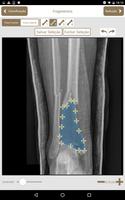 Osteotrauma capture d'écran 2