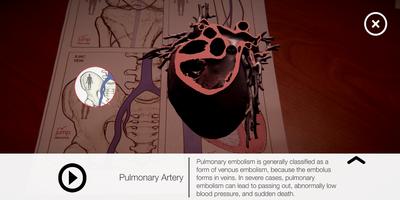 AR Anatomy Affiche