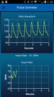 Pulse Oximeter capture d'écran 2