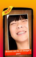 🌟 Braces Photo Editor Pro تصوير الشاشة 2