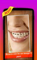 🌟 Braces Photo Editor Pro 포스터