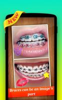 🌟 Braces Photo Editor Pro تصوير الشاشة 1