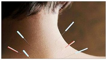Learn acupuncture online. Acup screenshot 2