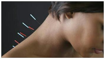 Aprenda a acupuntura com vídeo imagem de tela 3