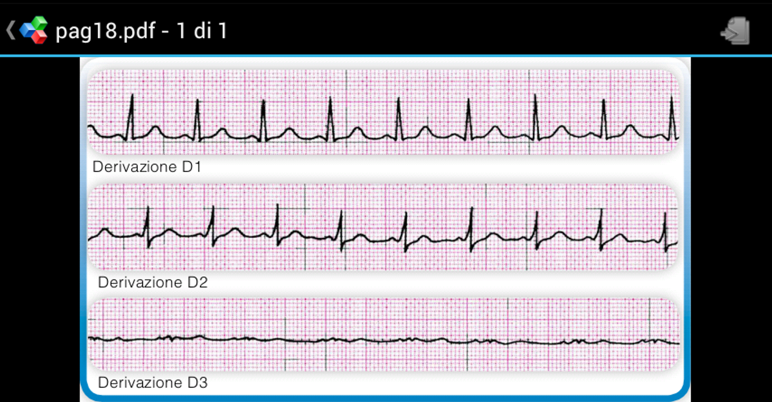 ecg app release date