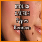 Moles cause and how to remove 图标