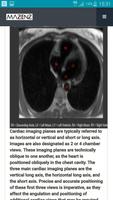 CardioMRI capture d'écran 1