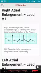 ECGCardio APK download