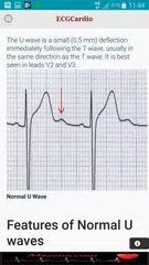 ECGCardio APK download
