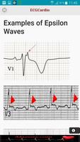 ECGCardio screenshot 7