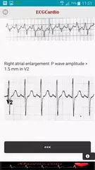ECGCardio APK download