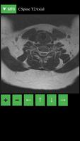 MRI Viewer screenshot 3