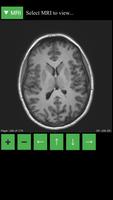 MRI Viewer Poster