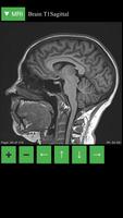 MRI Viewer capture d'écran 1