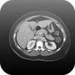 Radiology CT Viewer