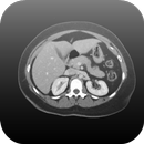 Radiology CT Viewer APK