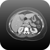 Radiology CT Viewer ícone