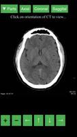 Radiology CT Viewer Cartaz