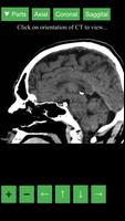 برنامه‌نما Radiology CT Viewer عکس از صفحه