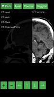 Radiology CT Viewer capture d'écran 3