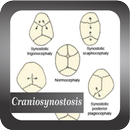 Recognize Craniosynostosis Disease APK