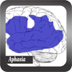 Recognize Aphasia Disease
