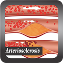 Recognize Arteriosclerosis Disease APK