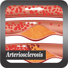 Recognize Arteriosclerosis Disease-icoon