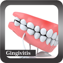 Recognize Gingivitis Disease APK