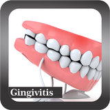 Recognize Gingivitis Disease ไอคอน