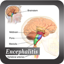 Recognize Encephalitis Disease APK