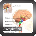 Recognize Encephalitis Disease simgesi