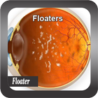 Recognize Floater Disease ikona