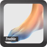 Recognize Frostbite Disease icône
